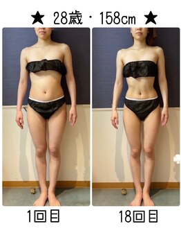 トリニティ 横浜店(TRINITY)の写真/【全身Detox痩身★90分】本気ダイエット全力応援