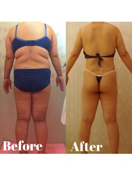 トータルビューティサロン クイーン(Queen)/30キロ以上の大幅減量も!