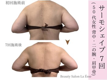 ラエッセ(La Esse)/後ろ姿も別人級に変化!