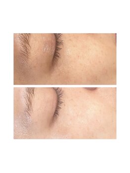 ノノサロン(nono salon)/