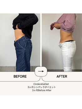 オーシャン整骨院(OCEAN整骨院)/３ヶ月ダイエットコース