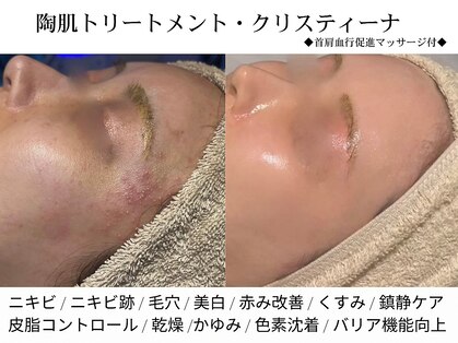 シェリーミル(Cherie Miru)の写真