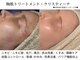 シェリーミル(Cherie Miru)の写真