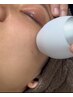 【全顔シミケア】　両頬うっすらと気になる方へ【New】　