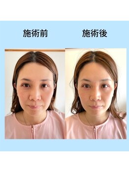 名古屋鍼灸 美容健康院/ビフォーアフター