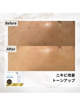 ルアナ(Luana)/セラピールの効果★