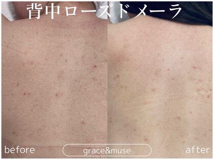グレイス アンド ミューズ(grace&muse)の写真