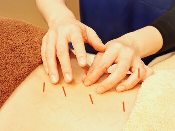 ハル(Halu)の写真/【神戸駅すぐ】慢性的な首肩こり/辛い痛みに◎鍼とお灸を使った施術で首肩こりを根本改善します*