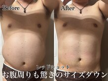 アンドエス 六本木(and S.)/最新脂肪分解でお腹もサイズdown