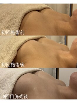 シーズボーテ(C's Beaute)/痛みなし◎自然なバストアップ