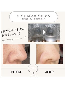 マヴィ くずは店(MavY.)/毛穴汚れバイバイ