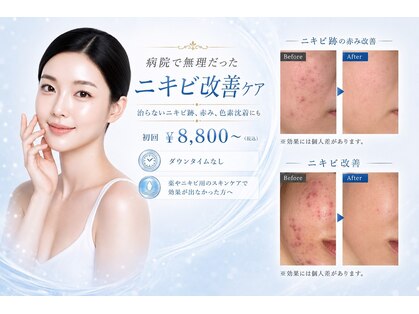 シャルナ(charna)の写真