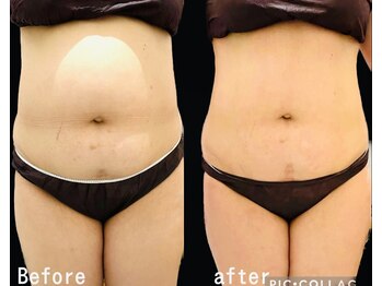 トータルビューティー air