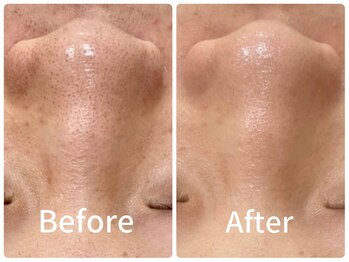 ジョアアンジェ 京橋店(joie ange)/クリスティーナでちゅるん毛穴に