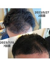 リリーボーテ 下北沢/Re:DIVINE再生美容～育毛促進編