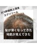 最新エクソソーム頭皮ケア【薄い髪の毛/分け目/ボリューム】3回￥19,800