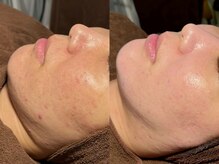 ルーナジェーナ(Luna llena)/池袋　エステ　ルーナジェーナ