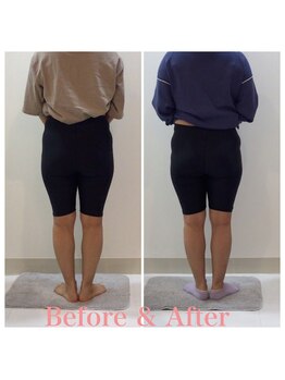 スタイルラボ高松/産後骨盤矯正の効果♪