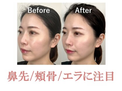 ラプリ 横浜店(Raplit)の写真