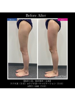 リアン/【痩身/毛穴/たるみケア】