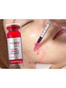 小顔になりたい