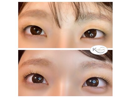 クルン(KURUN)の写真