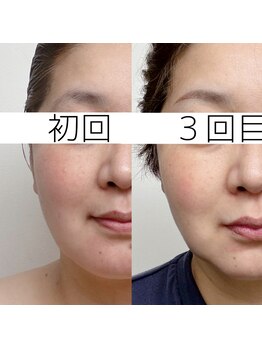 シーズボーテ(C's Beaute)/人気急上昇★40代のリフトUPケア