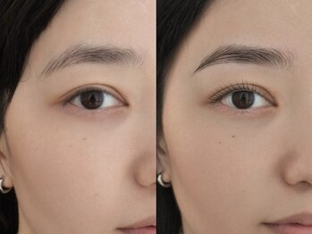 ネストアイ(NEST eye)の写真/元々持っている魅力を引き出すデザイン