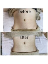 イハナ(IHANA)/デトックスして痩せ体質へ