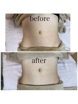 イハナ(IHANA)/デトックスして痩せ体質へ