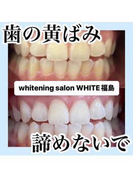 ホワイトニングサロン ホワイト(WHITE)/諦めないで