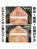 【赤ら顔/敏感/乾燥肌を改善！】ゆらぎに負けない強い肌作り◎健康美肌へ！
