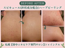 プライベートエステサロン トゥインクル