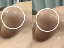 ゴホウビ オキナワ(GOHOBI OKINAWA)/お肌が奇麗だと気分も上がる♪