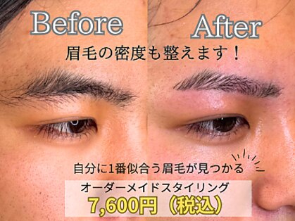 ビオプラス(BIO PLUS)の写真