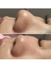 パッチ バイ サロンデヤンス(Patch by SALON DE YANSU)/