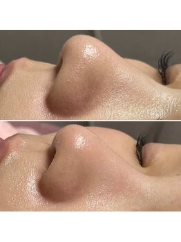 パッチ バイ サロンデヤンス(Patch by SALON DE YANSU)/