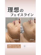 ジヒカ(ZIHICA)/【肌育フルコース】