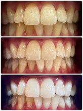 ルフレ(Reflet)/近くで見ても自信の持てる白さに