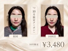 asmot鍼灸 整体院 代々木上原(asmot鍼灸 整体院)