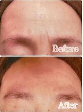 ブランシェ 金沢店 × 椿/シワ・たるみケア　お客様