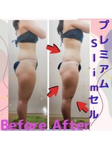 ゲットレディー マイ スリムレディー/１回の施術で!!