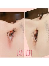 ヴィーナスコート(VENUSCOAT)/マツパ　Before　＆　After