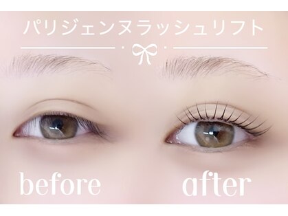 チャーム(charm)の写真