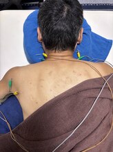 フラット柏(FLAT柏)/左肩の痛み、肩こりの鍼＆電気