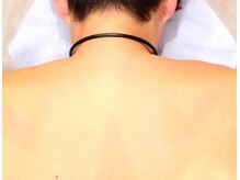 モテテ(motete.)の雰囲気（男女ともに人気のお全身脱毛♪脱毛することで毛穴レスな美肌に）