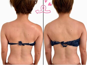 エ アラ エ(E.ala.e)/深部リンパ一回でこの違い!