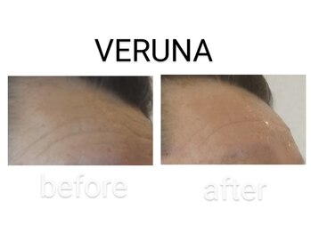 レヴェランジュ(Rebellange)/