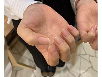 パラスパガーデン 福岡(para spa GARDEN)/【　ネイルケア　】