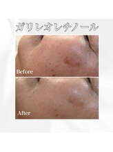 エレナ 伊勢崎(Ele'na)/ガリレオレチノール